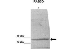 Rab3D Rabbit anti-Human, Polyclonal, Novus Biologicals 0.1 mL; Unconjugated:Antibodies,